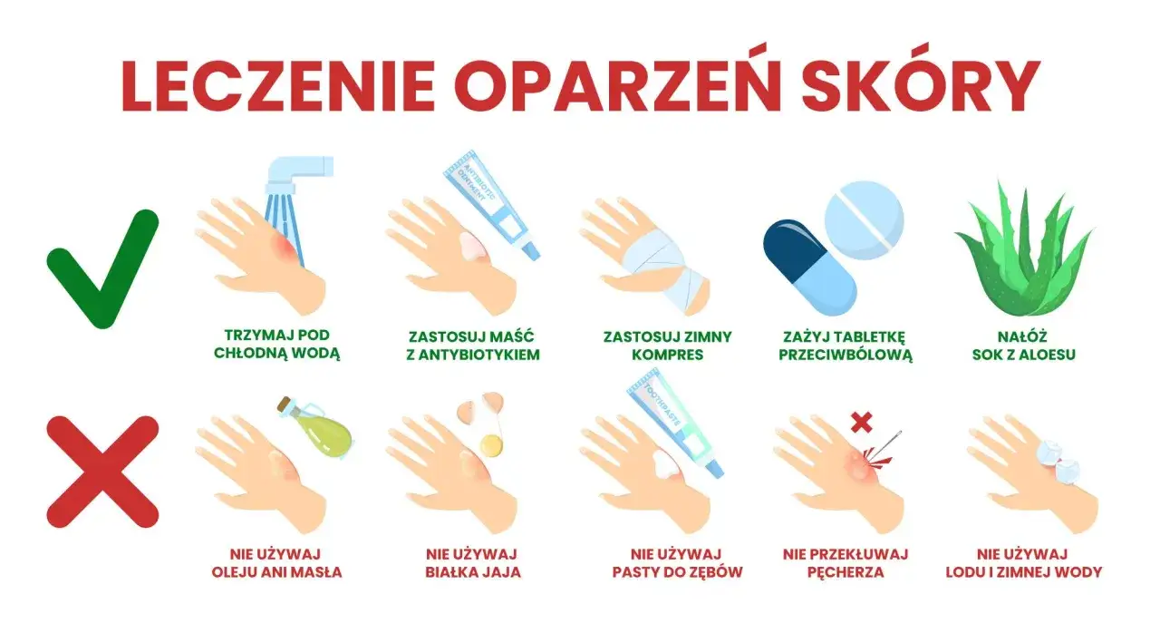 Co na oparzenie olejem? Chłodna woda, maść z antybiotykiem, zimny kompres, tabletki przeciwbólowe, sok z aloesu. Nie używaj oleju, masła, białka jaja, pasty do zębów, lodu.