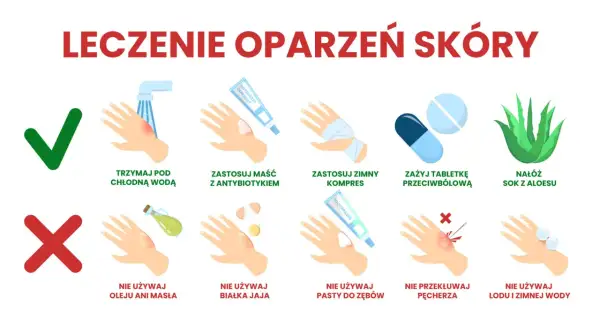 Co na oparzenie olejem? Chłodna woda, maść z antybiotykiem, zimny kompres, tabletki przeciwbólowe, sok z aloesu. Nie używaj oleju, masła, białka jaja, pasty do zębów, lodu.